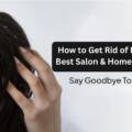 How to Get Rid of Dandruff: Best Salon & Home Remedies