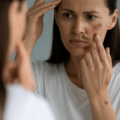 8 Reasons Why Your Skin is Getting Darker & What Can You Do About It